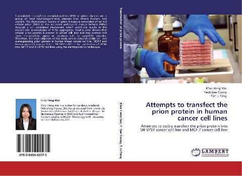 Attempts to transfect the prion protein in human cancer cell lines: Attempts to stably transfect the prion protein into SH-SY5Y cancer cell line and MCF-7 cancer cell line