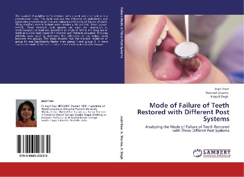 Mode of Failure of Teeth Restored with Different Post Systems: Analyzing the  Mode of Failure of Teeth Restored with Three Differnt Post Systems