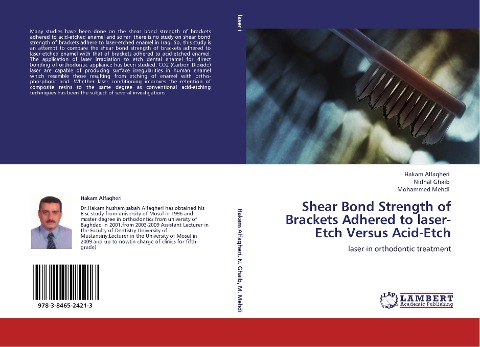 Shear Bond Strength of Brackets Adhered to laser-Etch Versus Acid-Etch: laser in orthodontic treatment