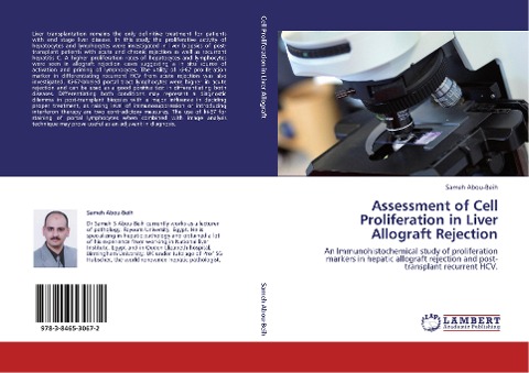 Assessment of Cell Proliferation in Liver Allograft Rejection: An Immunohistochemical study of proliferation markers in hepatic allograft rejection and post-transplant recurrent HCV.