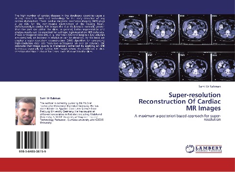 Super-resolution Reconstruction Of Cardiac MR Images: A maximum a-posteriori based approach for super-resolution