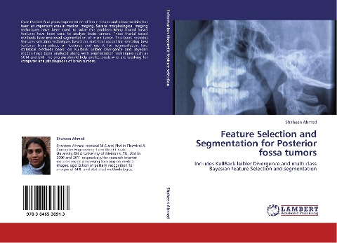 Feature Selection and Segmentation for Posterior fossa tumors: Includes KullBack leibler Divergence  and multi class Bayesian feature Selection and segmentation