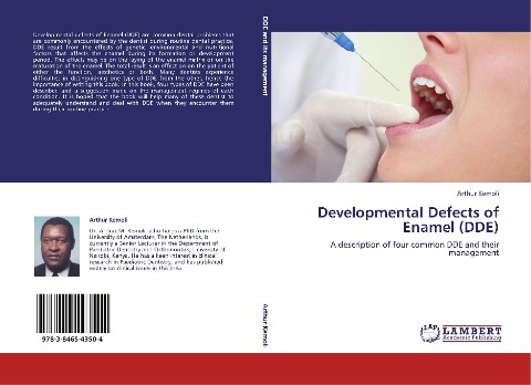 Developmental Defects of Enamel (DDE): A description of four common DDE and their management