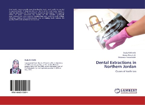 Dental Extractions in Northern Jordan: Causes of tooth loss