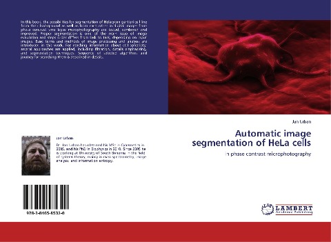 Automatic image segmentation of HeLa cells: in phase contrast microphotography