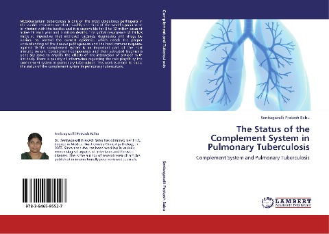 The Status of the Complement System in Pulmonary Tuberculosis: Complement System and Pulmonary Tuberculosis