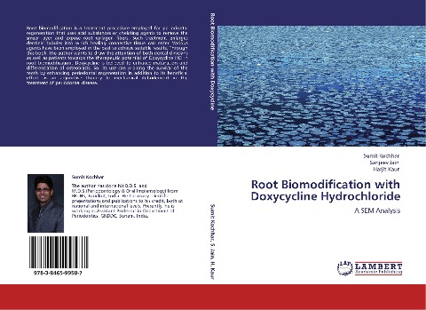 Root Biomodification with Doxycycline Hydrochloride: A SEM Analysis
