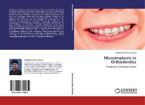 Microimplants in Orthodontics: Temporary Anchorage Device