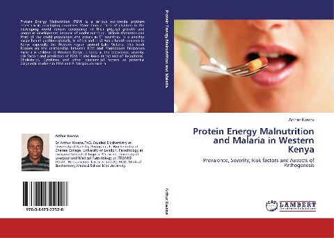 Protein Energy Malnutrition and Malaria in Western Kenya: Prevalence, Severity, Risk factors and Aspects of Pathogenesis