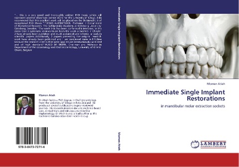 Immediate Single Implant Restorations: in mandibular molar extraction sockets