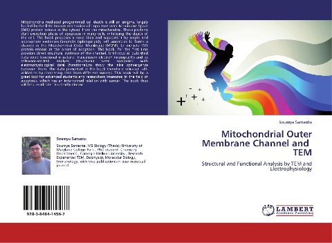 Mitochondrial Outer Membrane Channel and   TEM: Structural and Functional Analysis by TEM and Electrophysiology