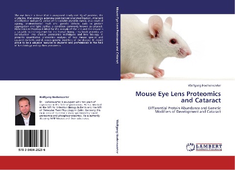 Mouse Eye Lens Proteomics and Cataract: Differential Protein Abundance and Genetic Modifiers of Development and Cataract