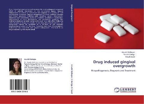 Drug induced gingival overgrowth: Etiopathogenesis, Diagnosis and Treatment
