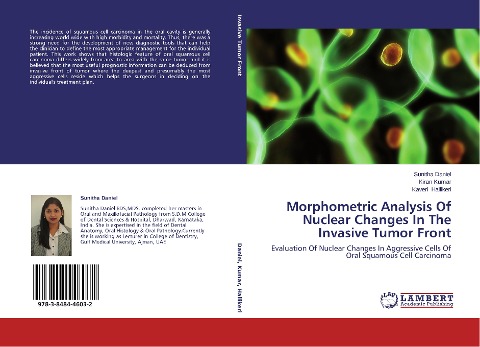 Morphometric Analysis Of Nuclear Changes In The Invasive Tumor Front: Evaluation Of Nuclear Changes In Aggressive Cells Of Oral Squamous Cell Carcinoma
