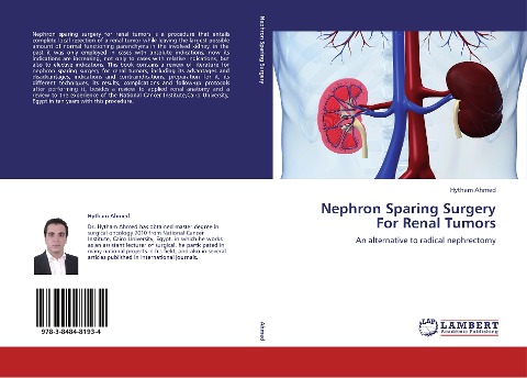 Nephron Sparing Surgery For Renal Tumors: An alternative to radical nephrectomy