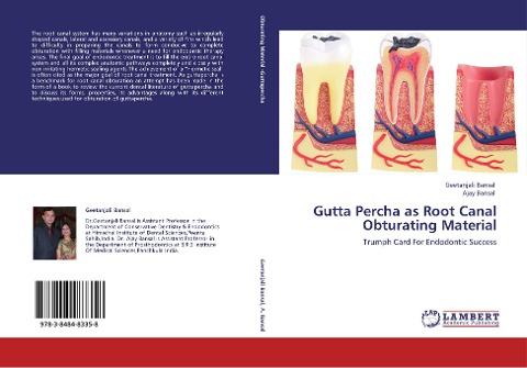Gutta Percha as Root Canal Obturating Material: Trumph Card For Endodontic Success