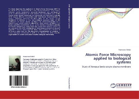 Atomic Force Microscopy applied to biological systems: Study of Xenopus laevis oocyte plasma membrane