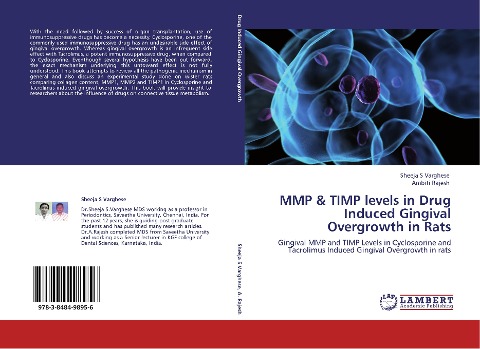 MMP & TIMP levels in Drug Induced Gingival Overgrowth in Rats: Gingival MMP and TIMP Levels in Cyclosporine and Tacrolimus Induced Gingival Overgrowth in rats