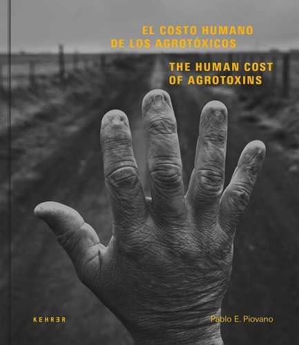 El costo humano de los agrotóxicos