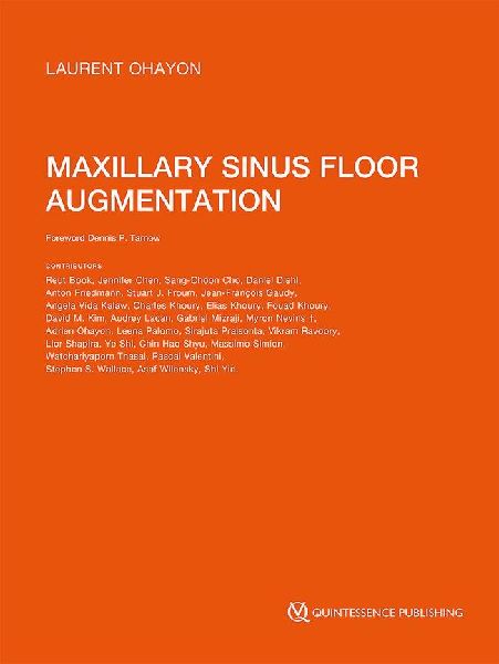 Maxillary Sinus Floor Augmentation