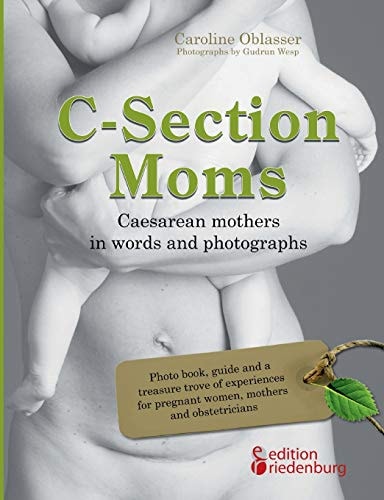 C-section Moms Caesarean Mothers in Words and Photographs