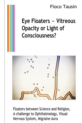 Eye Floaters - Vitreous Opacity Or Light of Consciousness? Floaters Between Science and Religion, A Challenge to Ophthalmology, Visual Nervous System, Migraine Aura