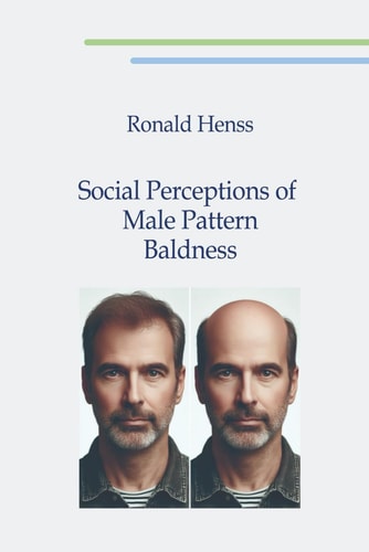 Social Perceptions of Male Pattern Baldness