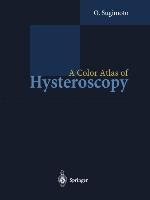 A Color Atlas of Hysteroscopy