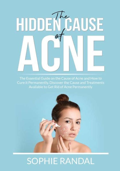 The Hidden Cause of Acne: The Essential Guide on the Cause of Acne and How to Cure it Permanently, Discover the Cause and Treatments Available to Get Rid of Acne Permanently
