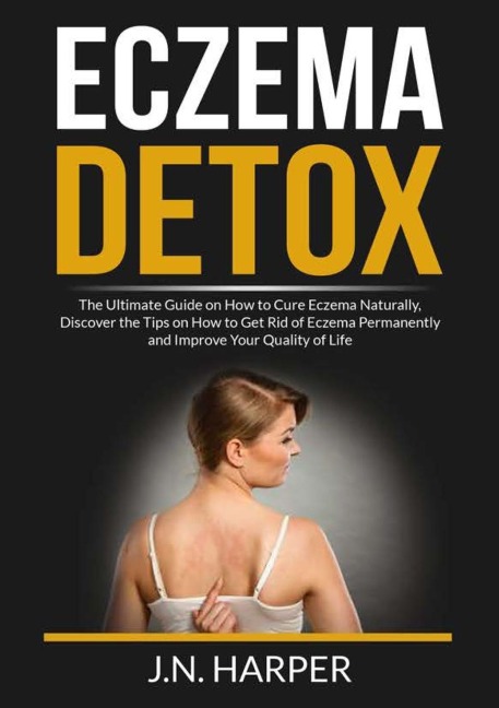 Eczema Detox: The Ultimate Guide on How to Cure Eczema Naturally, Discover the Tips on How to Get Rid of Eczema Permanently and Improve Your Quality of Life