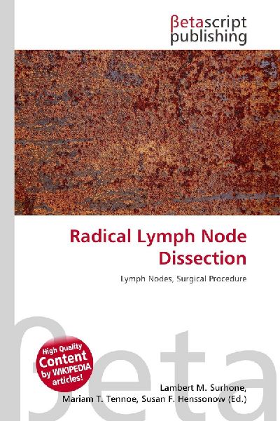 Radical Lymph Node Dissection: Lymph Nodes, Surgical Procedure