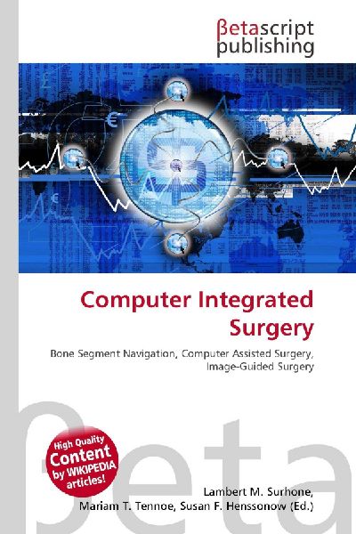 Computer Integrated Surgery: Bone Segment Navigation, Computer Assisted Surgery, Image-Guided Surgery