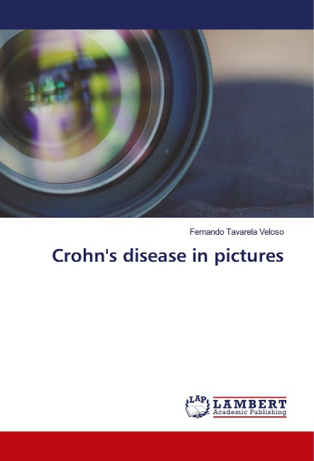 Crohns disease in pictures
