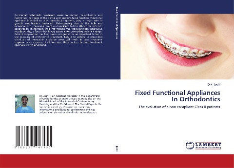 Fixed Functional Appliances In Orthodontics: The evolution of a non compliant Class II patients