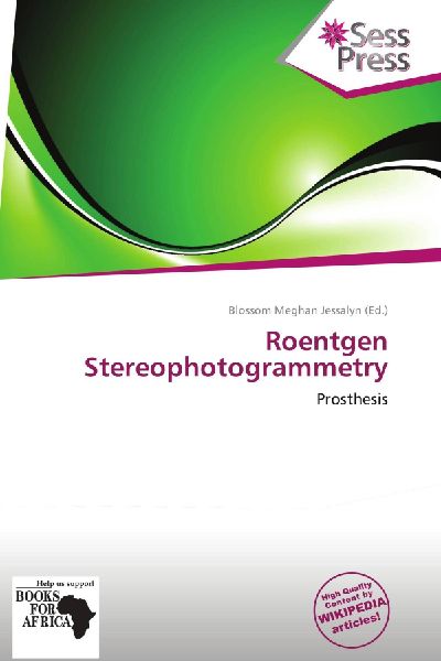 Roentgen Stereophotogrammetry: Prosthesis