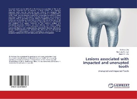 Lesions associated with impacted and unerupted tooth: Unerupted and Impacted Tooth