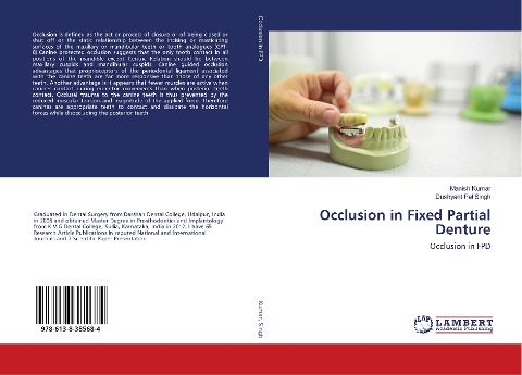 Occlusion in Fixed Partial Denture: Occlusion in FPD