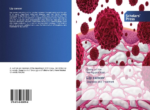Lip cancer: Diagnosis and Treatment