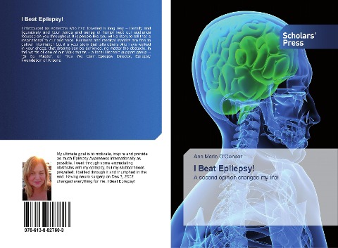 I Beat Epilepsy!: A second opinion changed my life!