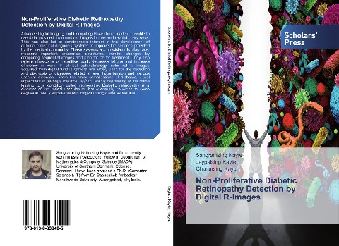 Non-Proliferative Diabetic Retinopathy Detection by Digital R-Images