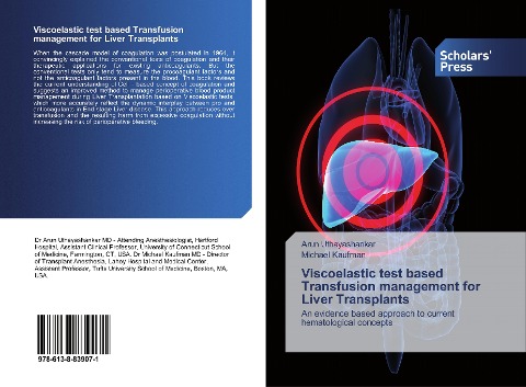 Viscoelastic test based Transfusion management for Liver Transplants: An evidence based approach to current hematological concepts