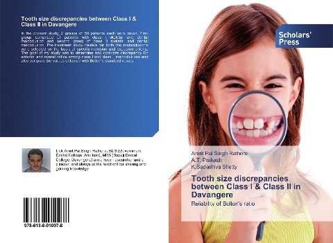 Tooth size discrepancies between Class I & Class II in Davangere: Reliability of Boltons ratio