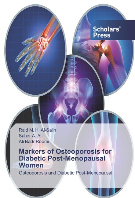 Markers of Osteoporosis for Diabetic Post-Menopausal Women: Osteoporosis and Diabetic Post-Menopausal