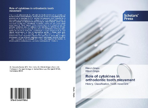 Role of cytokines in orthodontic tooth movement: History, Classification, Tooth movement