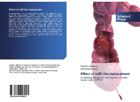 Effect of miR-34a replacement: on inhibiting the growth and migration of colon cancer cells, HCT116