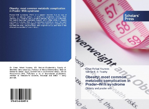 Obesity; most common metabolic complication in Prader-Willi syndrome: Obesity and prader willi