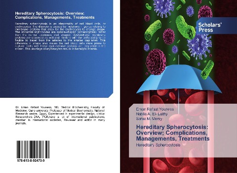 Hereditary Spherocytosis: Overview; Complications, Managements, Treatments: Hereditary Spherocytosis