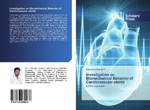 Investigation on Biomechanical Behavior of Cardiovascular stents: A FEA Approach