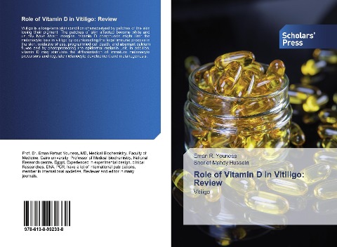 Role of Vitamin D in Vitiligo: Review: Vitiligo