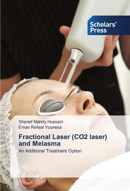 Fractional Laser (CO2 laser) and Melasma: An Additional Treatment Option